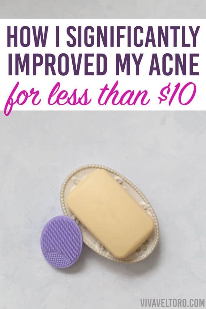 Best Treatment For Adult Acne