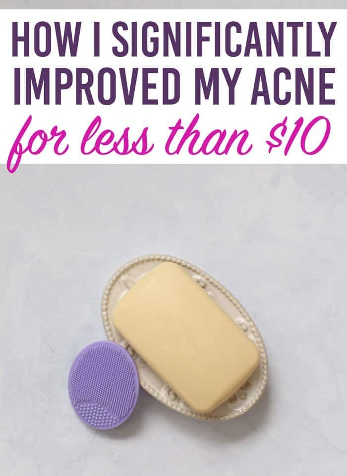 best acne treatment